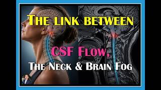 Brain Fog, Dizziness, and Neck Compression: What Research Shows